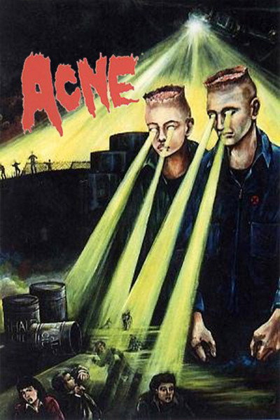 Póster de Acne
