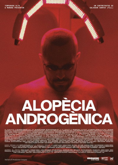 Póster de Alopècia androgènica