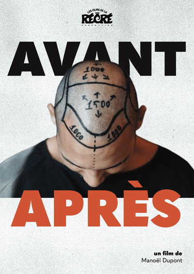 Póster de Before/After
