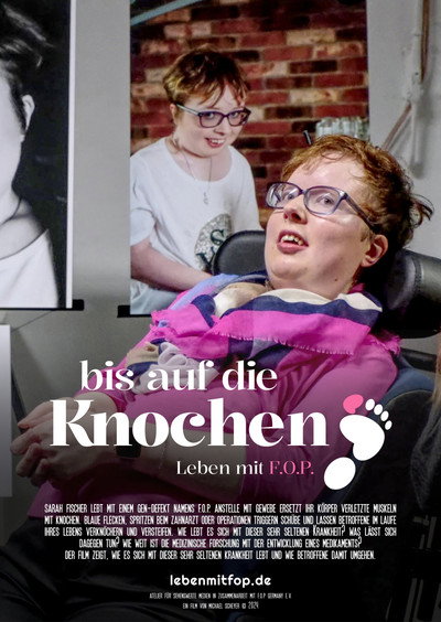 Póster de Bis auf die Knochen - Leben mit FOP