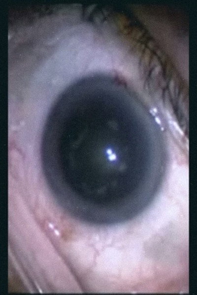 Póster de Botched Eyeball Operation