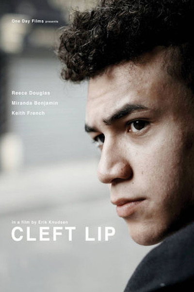 Póster de Cleft Lip