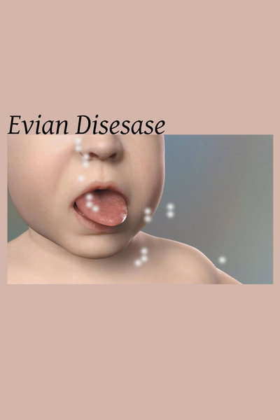Póster de Evian Disease