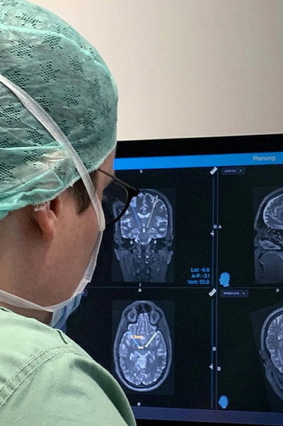 Póster de Gehirn unter Strom - Hilfe bei Depression, Epilepsie und Parkinson?