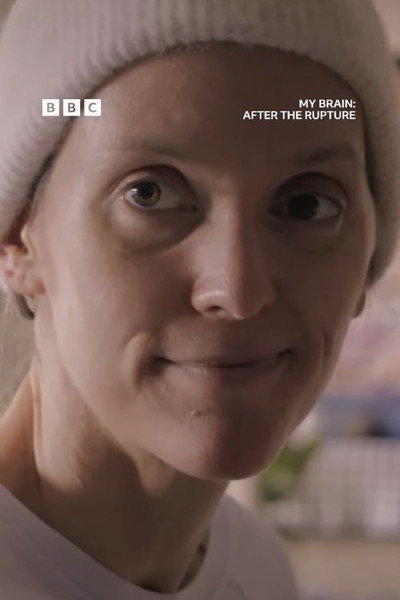 Póster de My Brain: After the Rupture