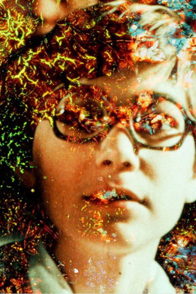 Póster de Pigment-Dispersion Syndrome