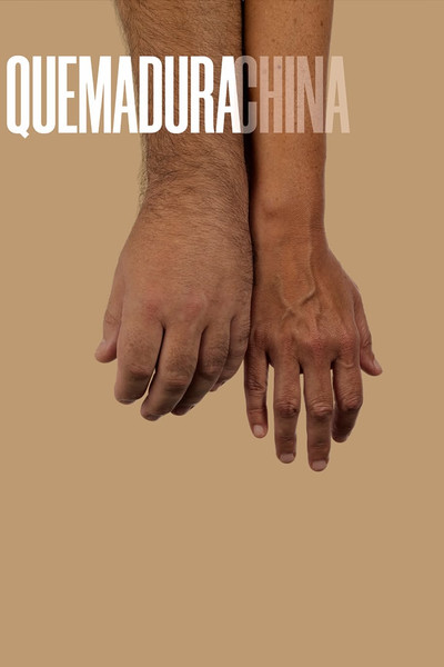 Póster de Quemadura China