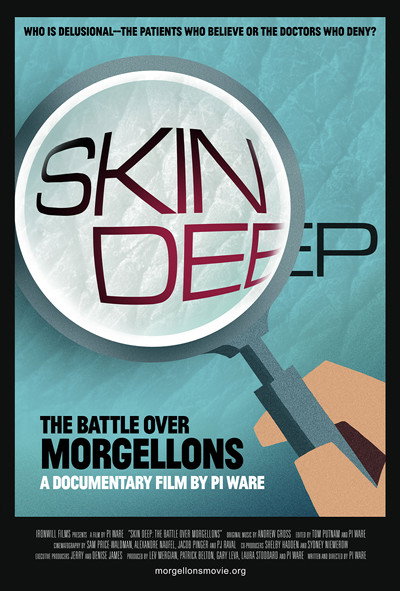 Póster de Skin Deep: The Battle Over Morgellons