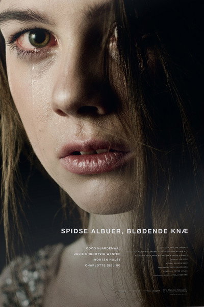 Póster de Spidse albuer, blødende knæ