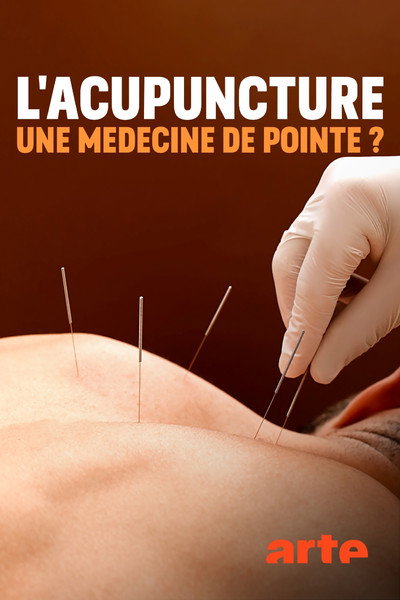 Póster de Spitzenmedizin: Akupunktur - Mythos oder Therapie?