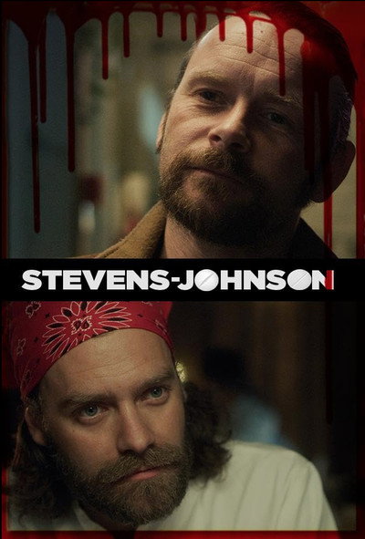 Póster de Stevens Johnson