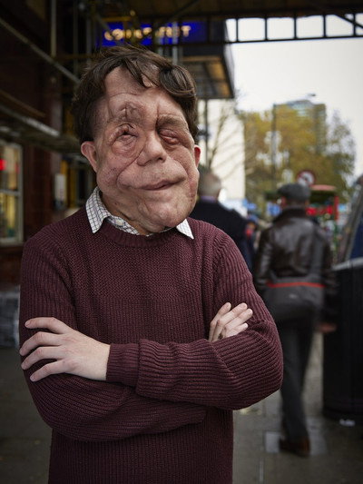 Póster de The Ugly Face of Disability Hate Crime