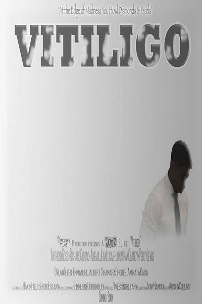 Póster de Vitiligo