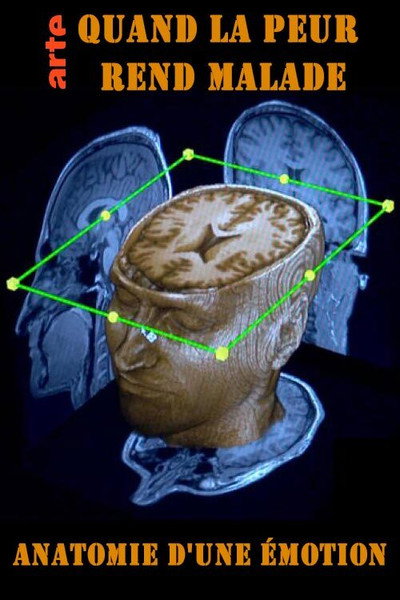 Póster de Wenn Angst krank macht: Anatomie eines Gefühls