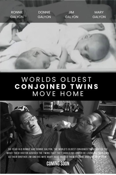 Póster de World's Oldest Conjoined Twins Move Home