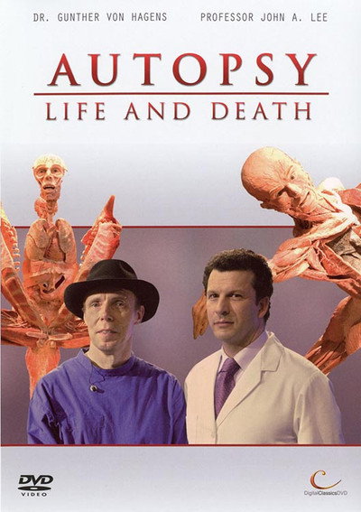 Póster de Autopsy: Life and Death