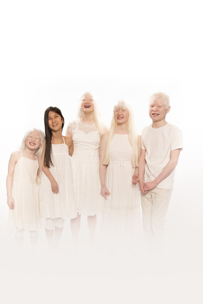 Póster de Born with Albinism